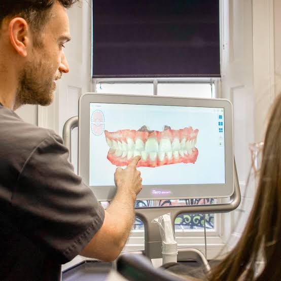 Personalized Clear Aligners Care